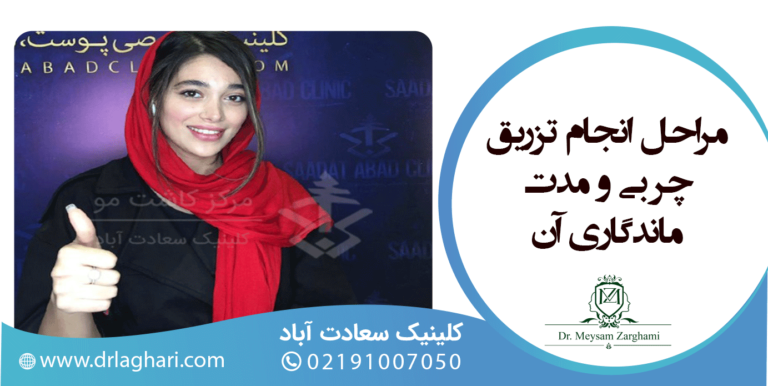 مراحل انجام تزریق چربی و مدت ماندگاری آن