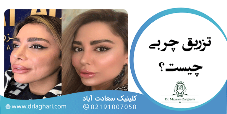 تزریق چربی چیست