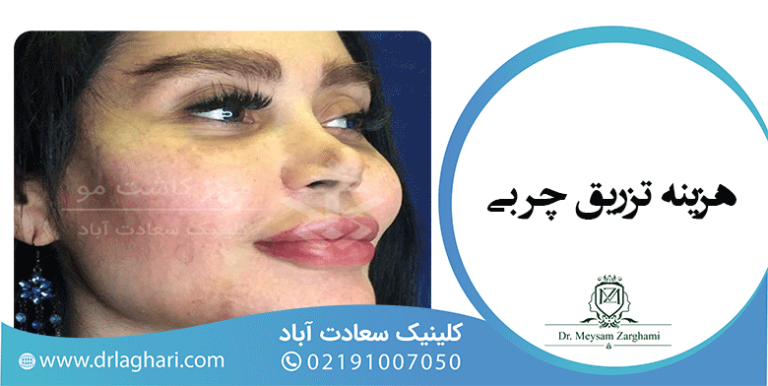 هزینه تزریق چربی