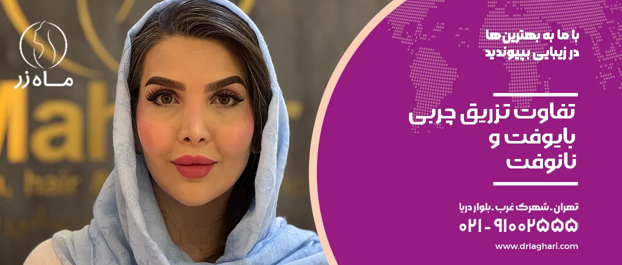 تزریق چربی به روش بایوفت
