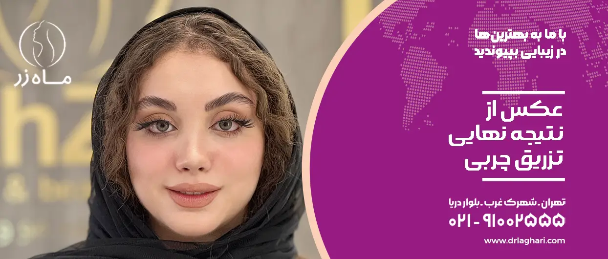 عکس نتیجه نهایی تزریق چربی