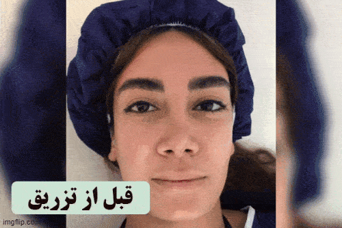 کلینیک تزریق چربی در تهران