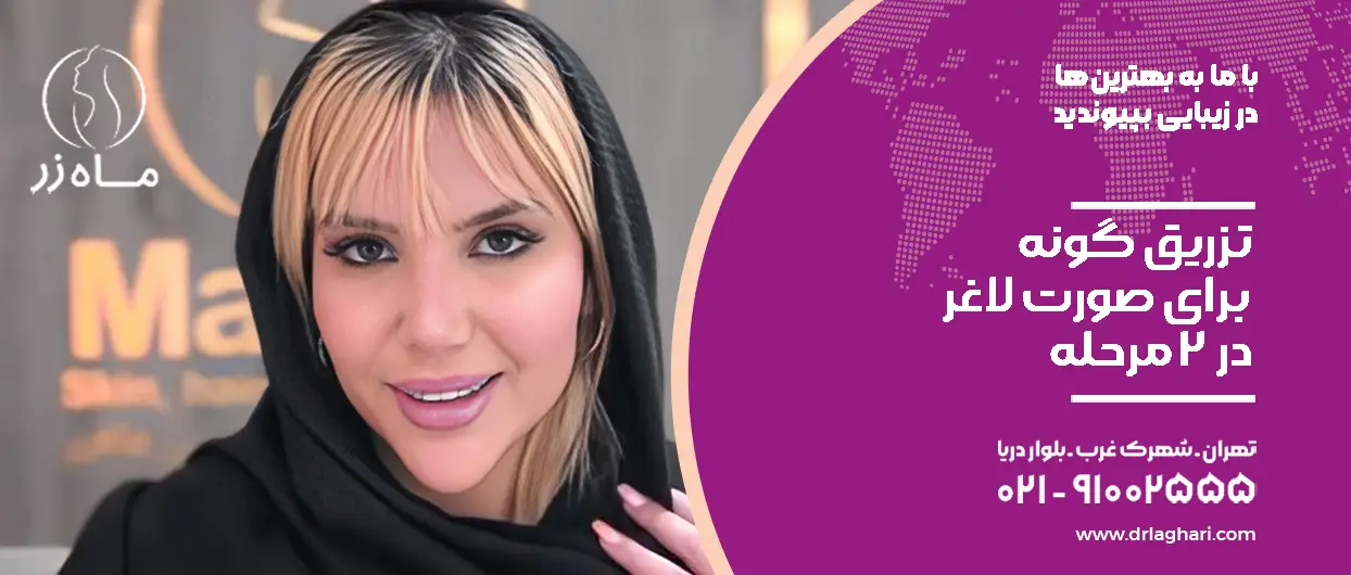 تزریق گونه برای صورت لاغر در 2 مرحله