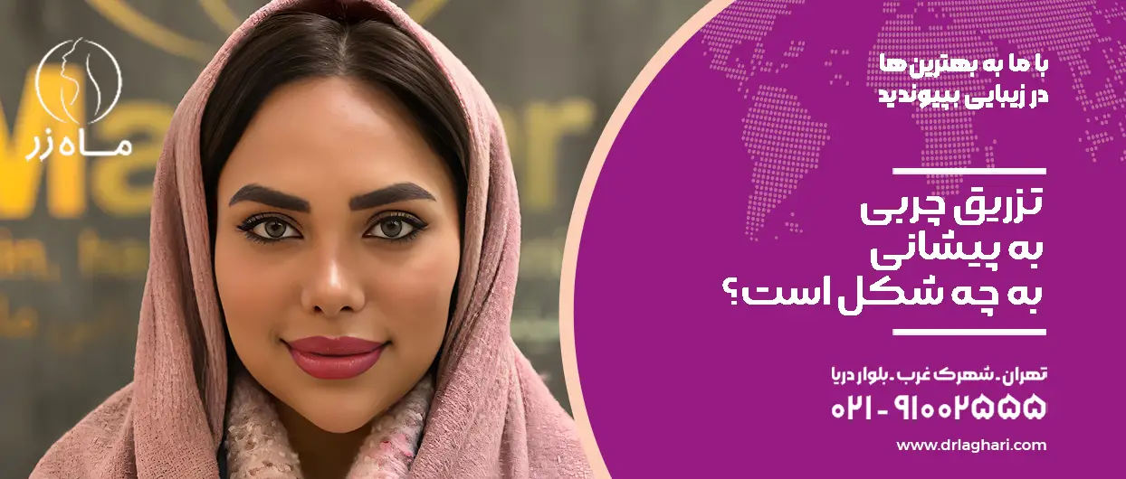 تزریق چربی به پیشانی