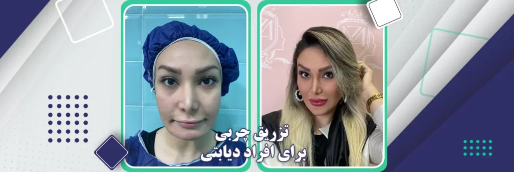 تزریق چربی برای افراد دیابتی امکان پذیر است؟