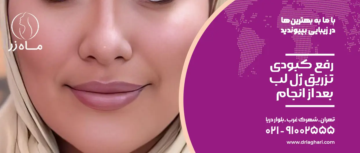 رفع کبودی تزریق ژل لب