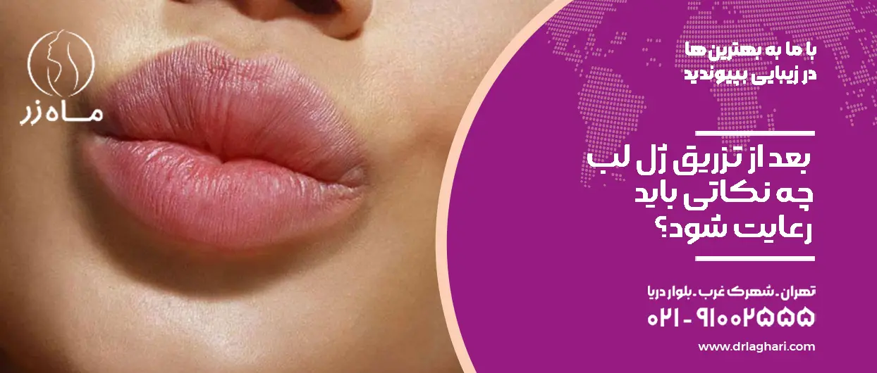 بعد از تزریق ژل لب چه نکاتی باید رعایت شود؟
