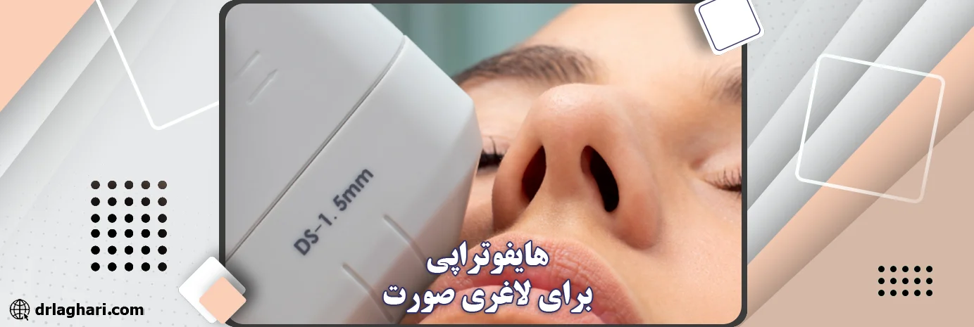 هایفوتراپی برای لاغری صورت