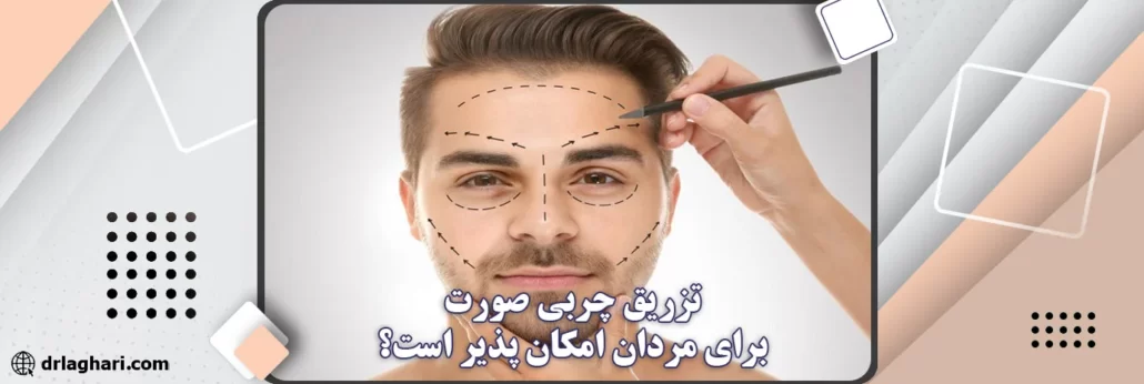 تزریق چربی صورت مردان