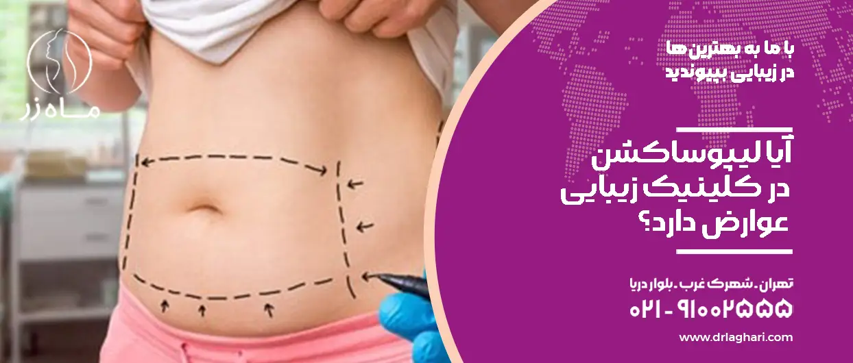 آیا لیپوساکشن عوارض دارد؟