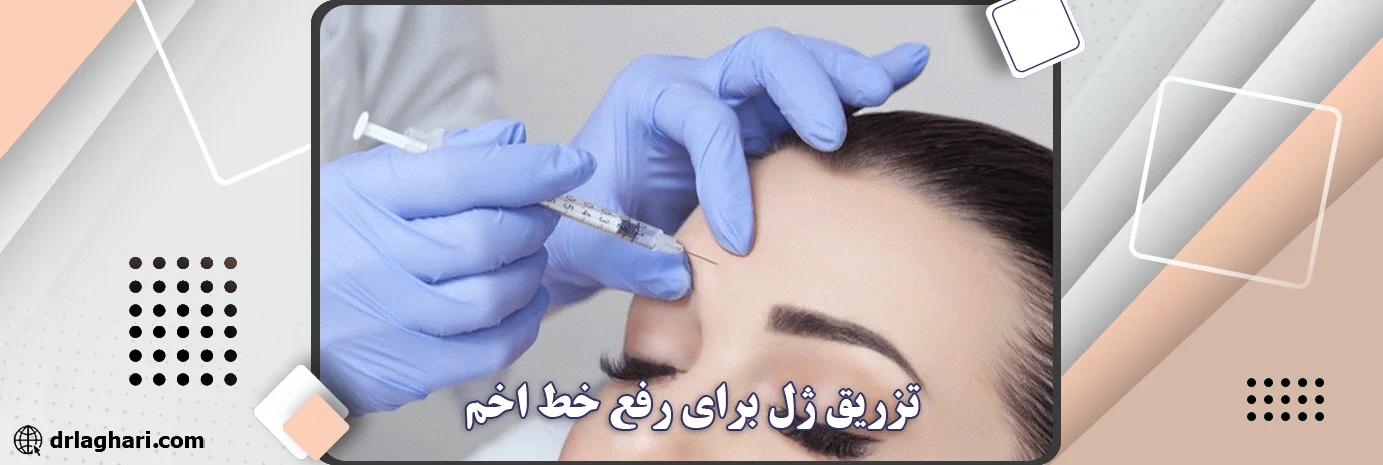 تزریق ژل برای رفع خط اخم