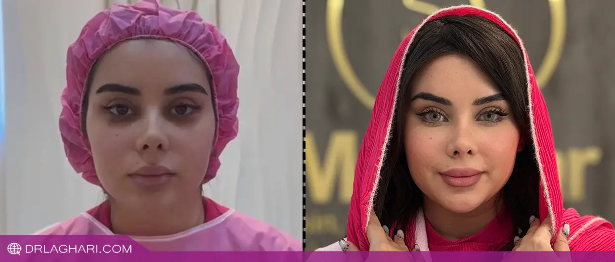 تفاوت بایوفت و نانوفت