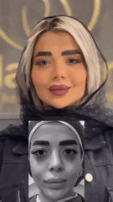 تفاوت تزریق چربی بایوفت و نانوفت چیست؟