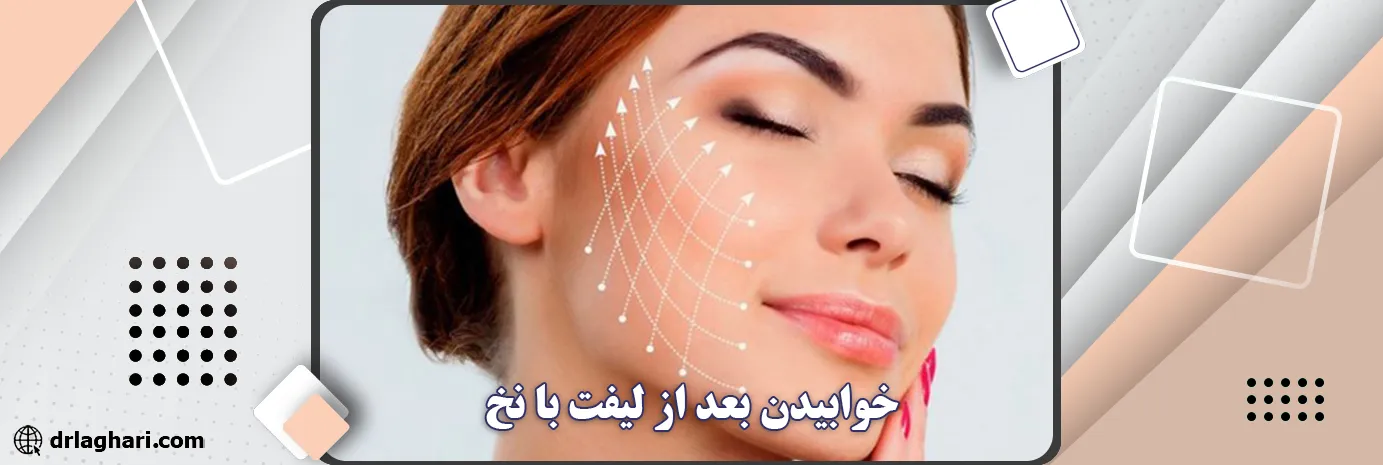 خوابیدن بعد از لیفت با نخ