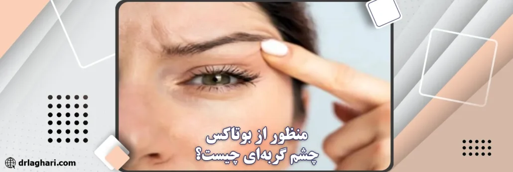 بوتاکس چشم گربه‌ای