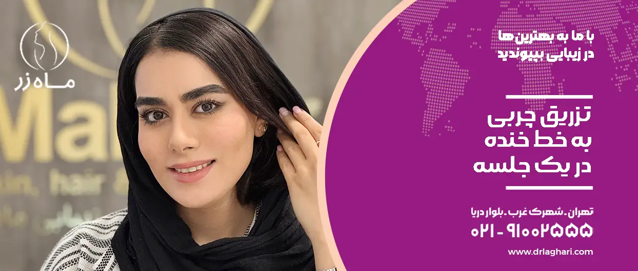تزریق چربی به خط خنده