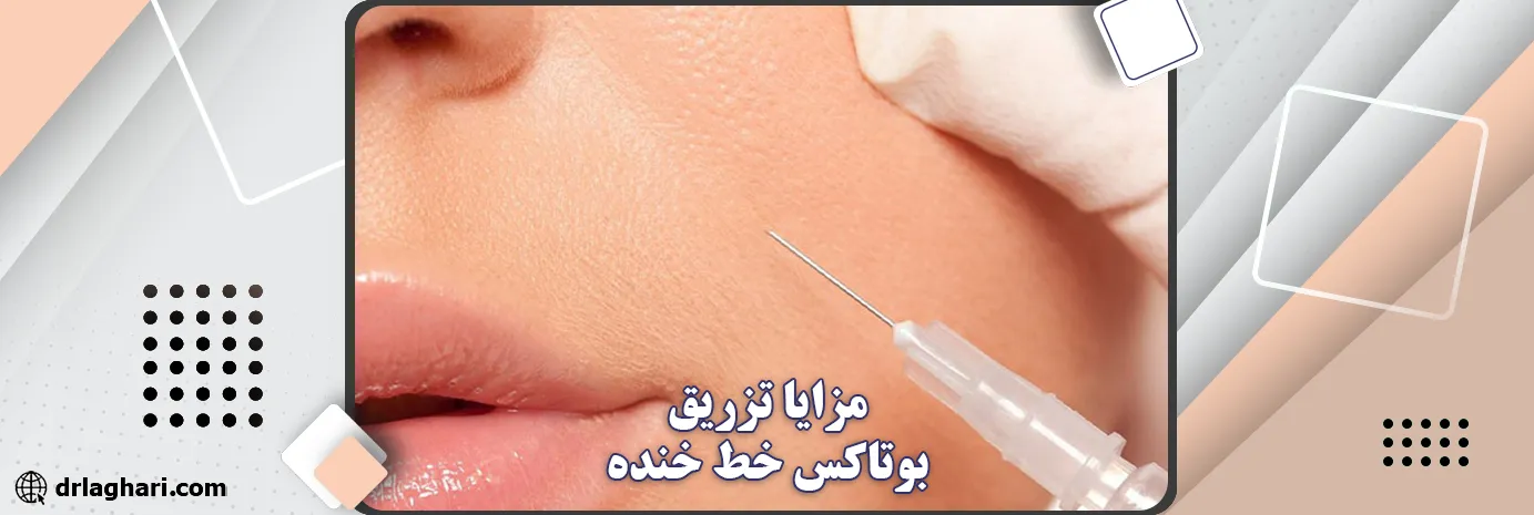 مزایا تزریق بوتاکس خط خنده