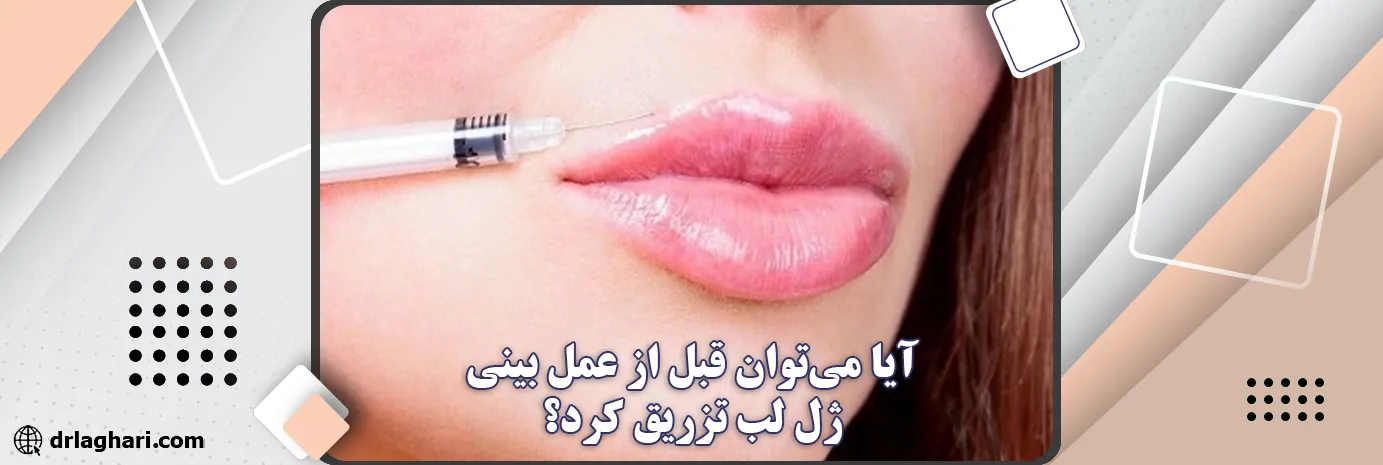 ژل لب بعد از عمل بینی