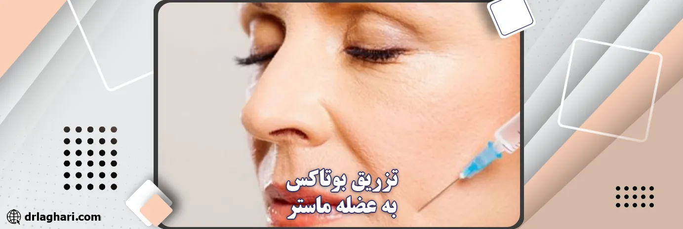 تزریق بوتاکس به عضله ماستر