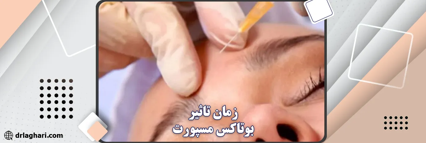 زمان تاثیر بوتاکس مسپورت
