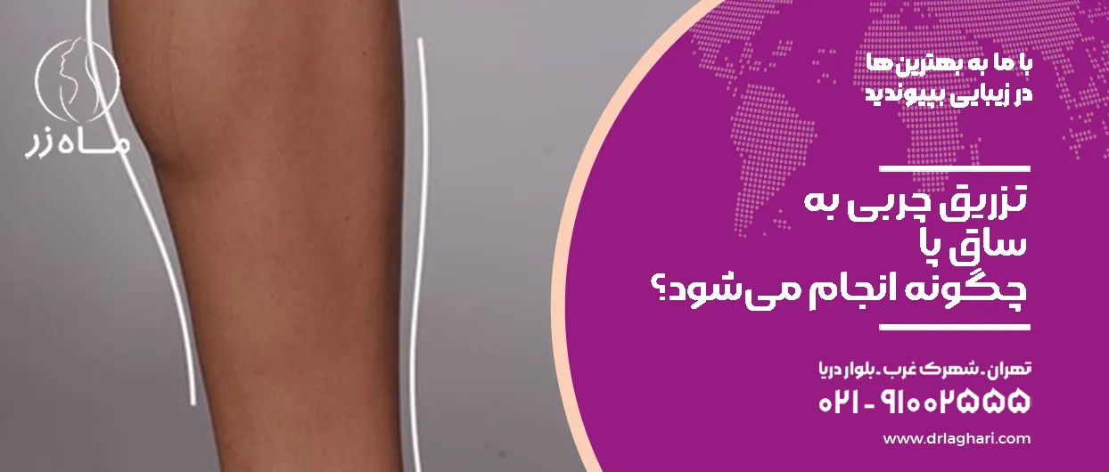 فواید تزریق چربی به مچ