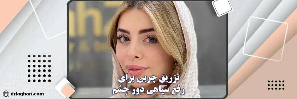 تزریق چربی برای رفع سیاهی دور چشم