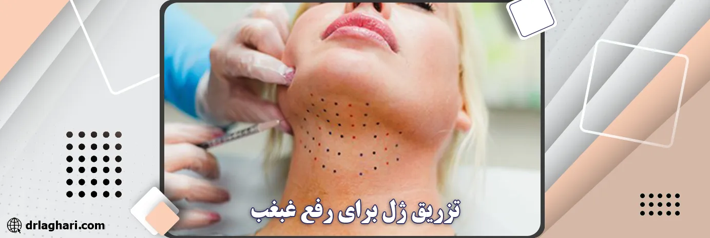 تزریق ژل برای رفع غبغب