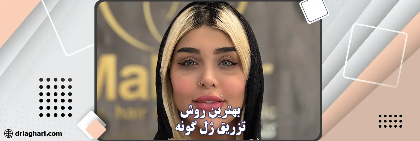 بهترین روش تزریق ژل گونه