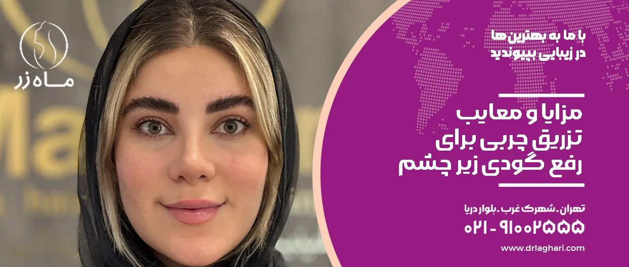 مزایا و معایب تزریق چربی برای رفع گودی زیر چشم