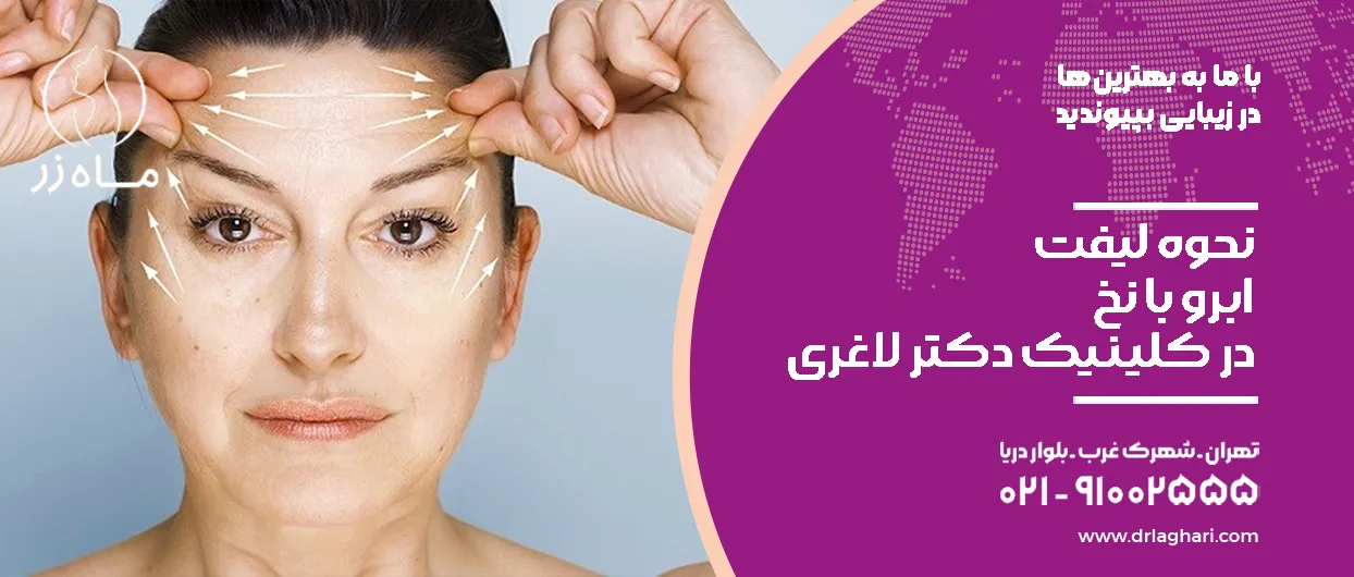نحوه لیفت ابرو با نخ