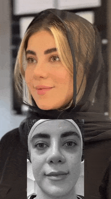 کلینیک زیبایی و تزریق چربی شهرک غرب