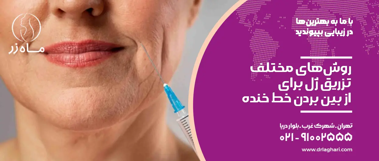 روش‌های مختلف تزریق ژل برای از بین بردن خط خنده