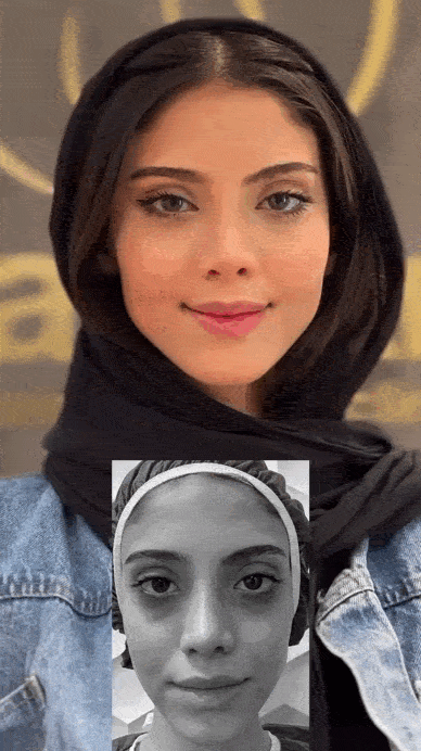 بهترین دکتر برای ترمیم تزریق چربی ناموفق