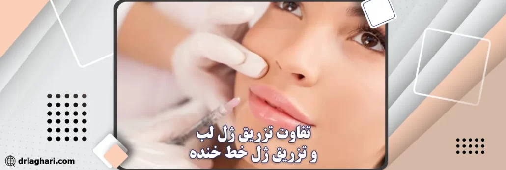 تفاوت تزریق ژل لب و تزریق ژل خط خنده