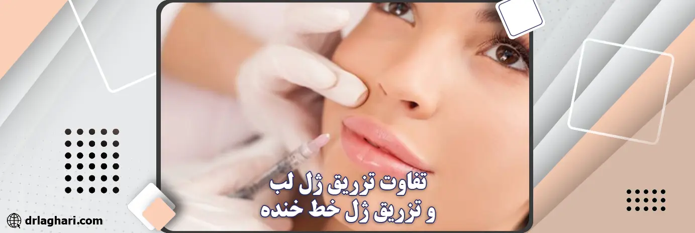 تفاوت تزریق ژل لب و تزریق ژل خط خنده