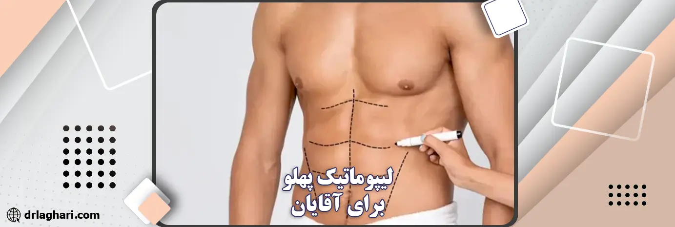 لیپوماتیک پهلو برای آقایان