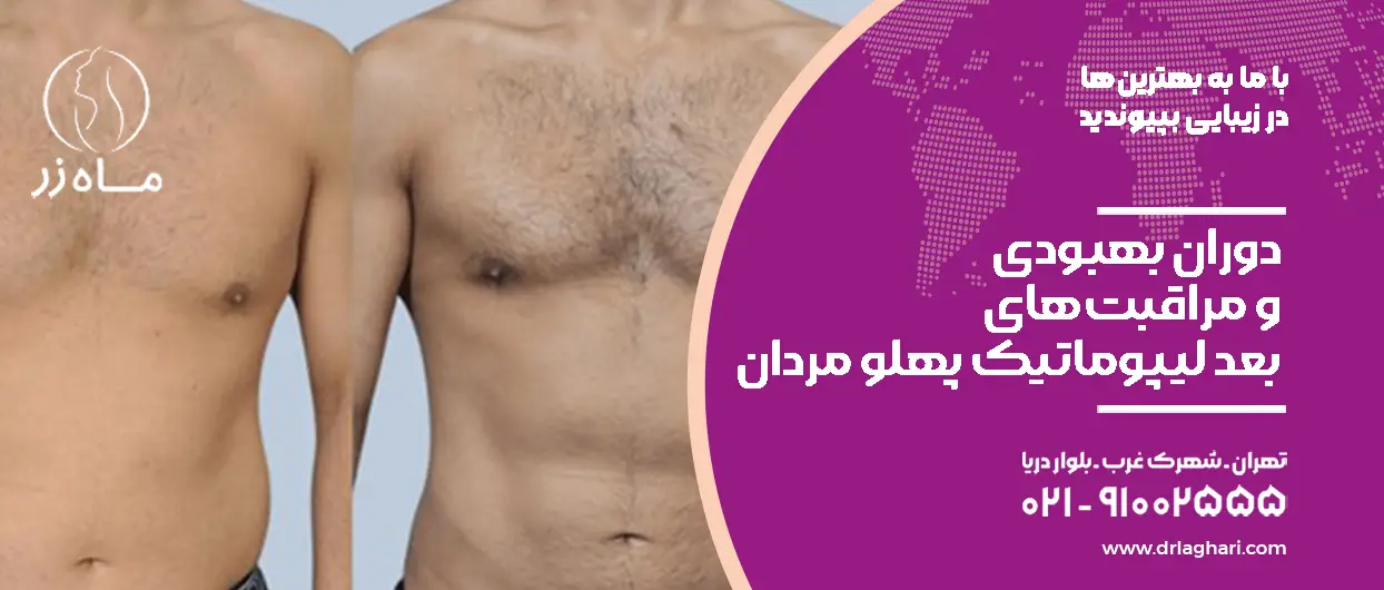 لیپوماتیک پهلو مردان