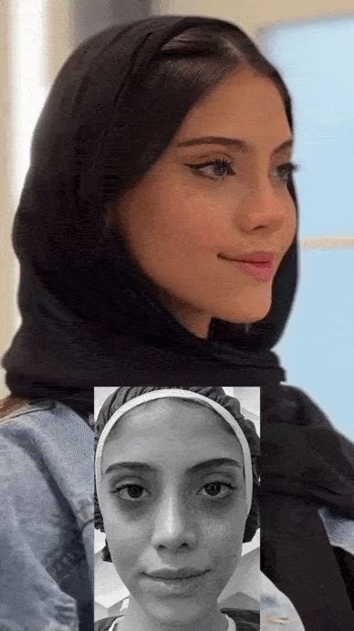 ماندگاری تزریق چربی در افراد لاغر