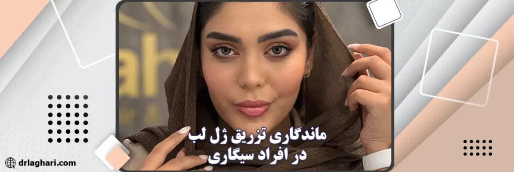 ماندگاری تزریق ژل لب در افراد سیگاری