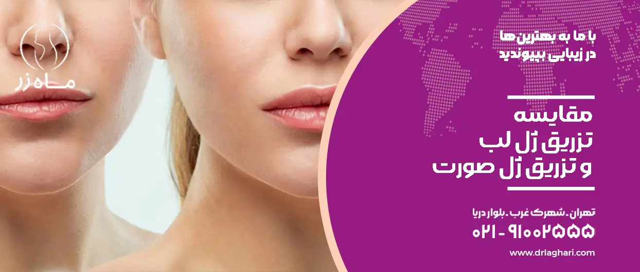 مقایسه تزریق ژل لب و صورت