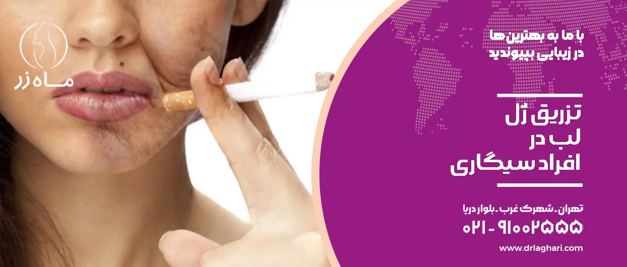 ژل لب افراد سیگاری