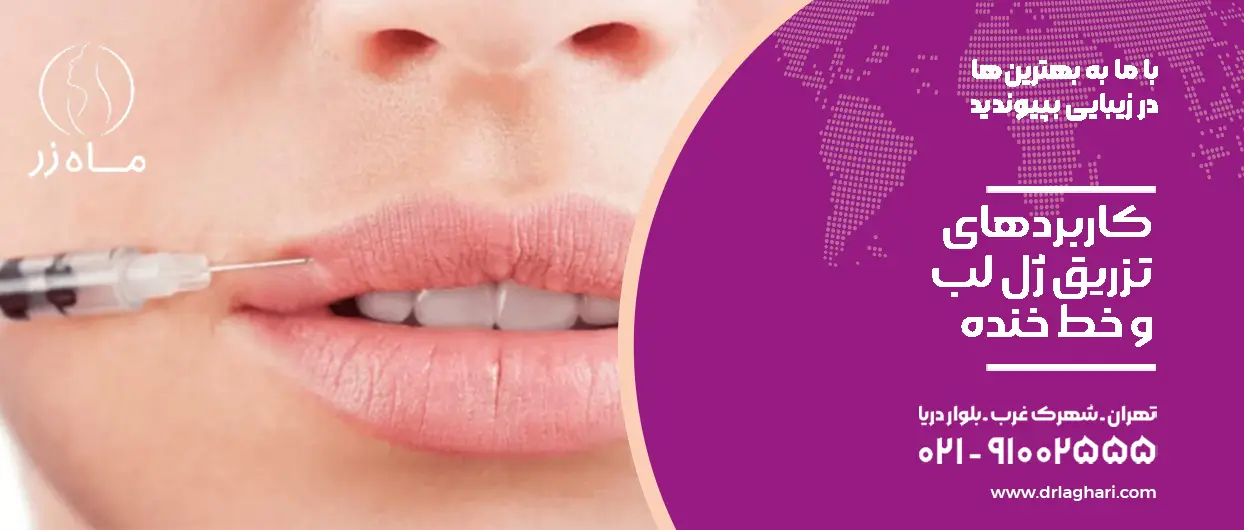 کاربردهای تزریق ژل لب و خط خنده