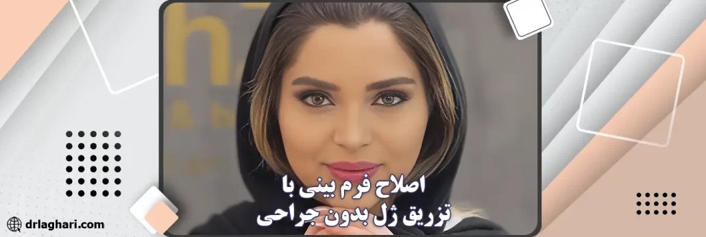 اصلاح فرم بینی با تزریق ژل بدون جراحی