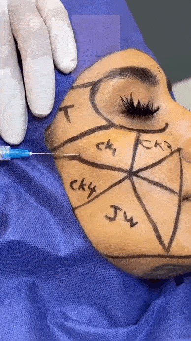 بهترین روش ترکیبی جوانسازی برای افراد بالای ۴۰ سال