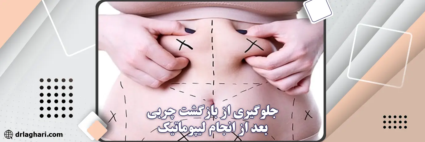 جلوگیری از بازگشت چربی