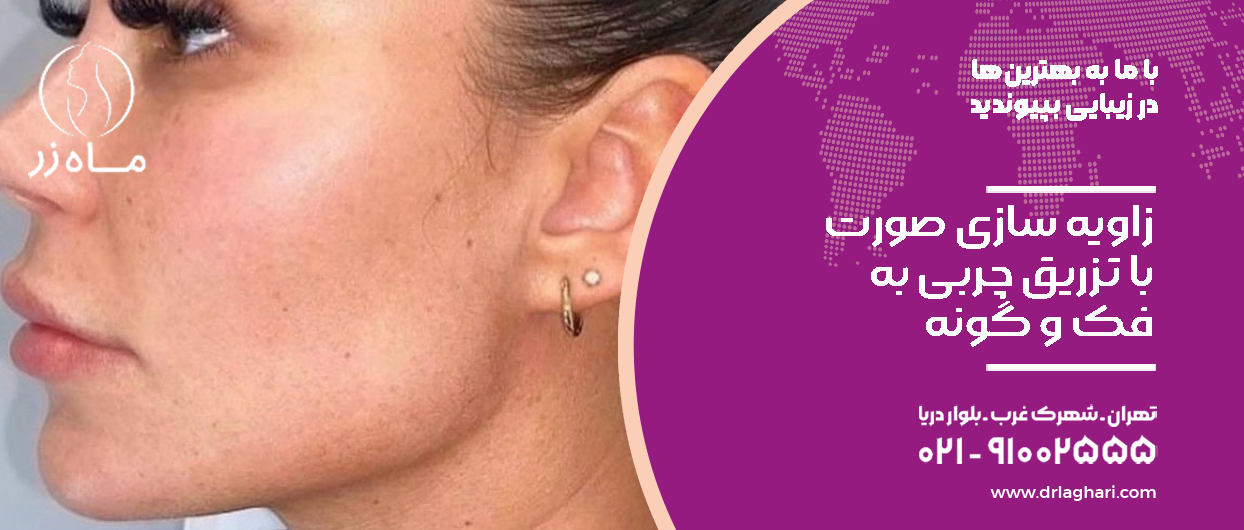 زاویه سازی صورت با چربی گونه و فک