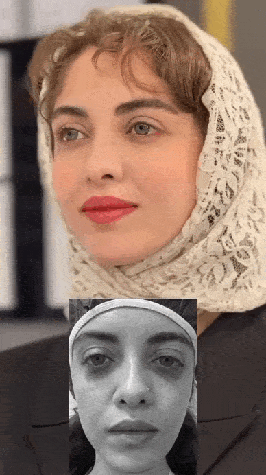 نکروز چربی چیست و چه درمانی دارد؟