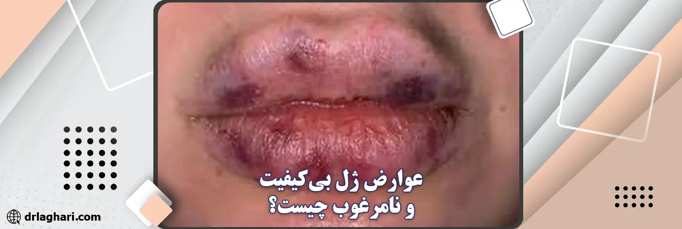 عوارض ژل بی‌کیفیت