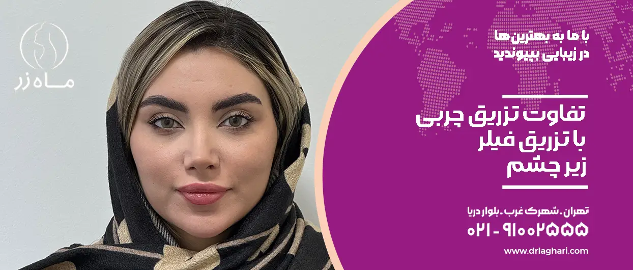 مقایسه تزریق چربی با فیلر