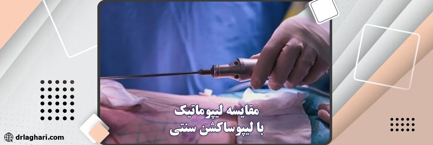 مقایسه لیپوماتیک با لیپوساکشن سنتی